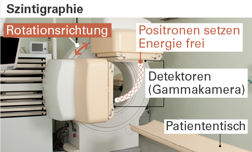 Skelettszintigramm