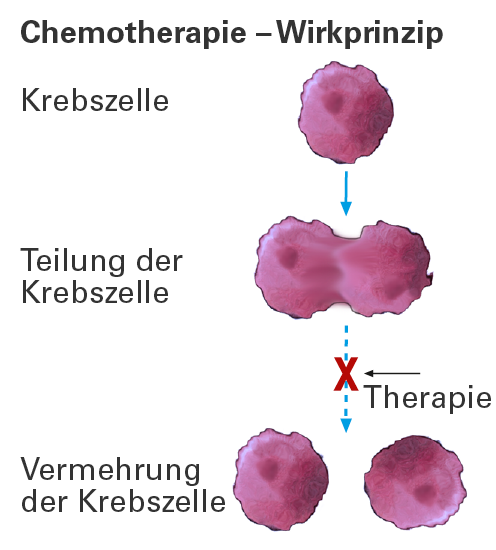 Chemotherapie