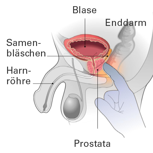 Tastuntersuchung