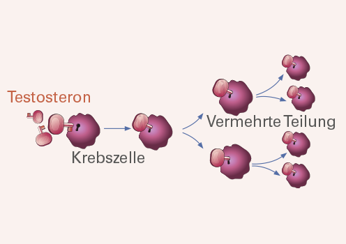 Testosteron und Prostatakrebs