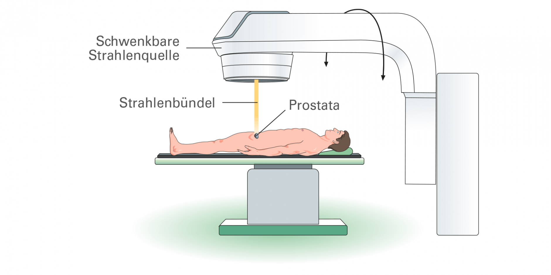 prostatakarzinom therapie bestrahlung prostatita este dăunătoare